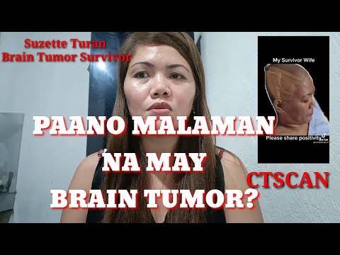 Video: Paano Kilalanin ang Mga Sintomas ng Neuromata (na may Mga Larawan)