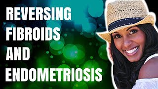 Healing Fibroids and Endometriosis w/ Jovanka Ciares