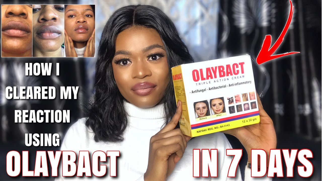 OLAYBACT TRIPLE ACTION CREAM CLEARED MY SKIN REACTION IN 7DAYS The Best Treatment Cream in