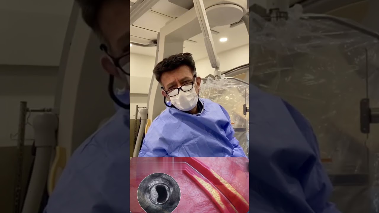 Bypass Konuşuluyordu, IVUS ile Karar Değişti