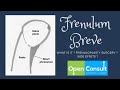 FRENULUM BREVE- FRENULOPLASTY surgery | फ्रेनुलम ब्रेवे - फ़्रेनुलोप्लास्टी सर्जरी | OpenConsult