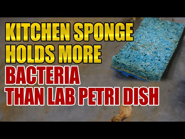 Study: Your Kitchen Sponge Has More Germs Than Your Toilet