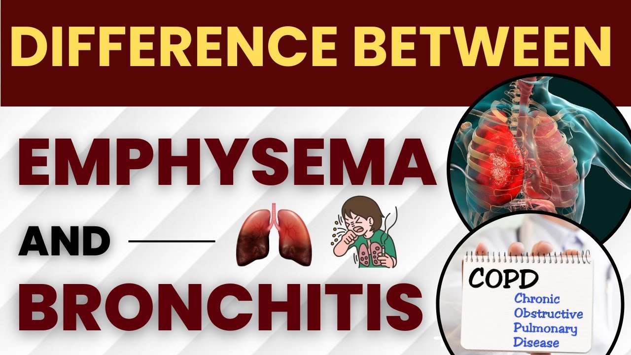 Difference Between Emphysema and Chronic Bronchitis Bronchitis Treatment in Hindi YouTube
