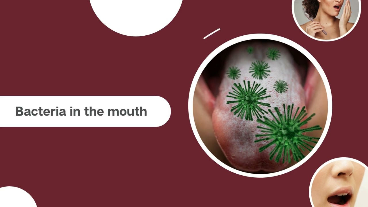 Halitosis Maintain fresh breath by brushing twice daily, including your tongue, and flossing...