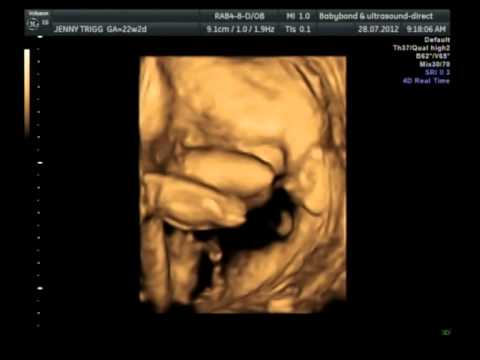 Baby girl 4D 22 weeks - YouTube