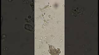 #trichomonas homonis in stool