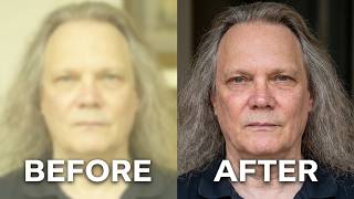 The No-B.S. Guide to Cataract Surgery (an Engineer Patient Testimonial)