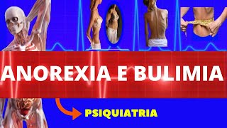 ANOREXIA E BULIMIA NERVOSA - CAUSAS, SINTOMAS, DIAGNÓSTICO E TRATAMENTO - DISTÚRBIOS ALIMENTARES ANOREXIA E BULIMIA NERVOSA - CAUSAS, SINTOMAS, DIAGNÓSTICO E TRATAMENTO - DISTÚRBIOS ALIMENTARES