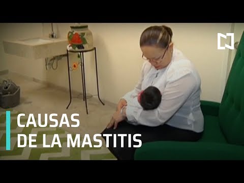 ¿Qué es la mastitis y sus síntomas? - Expreso de la Mañana