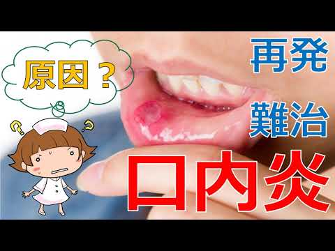 【原因不明の口内炎】口内炎の原因は？よくならない口内炎とは？口内炎にビタミン剤は効果ある？
