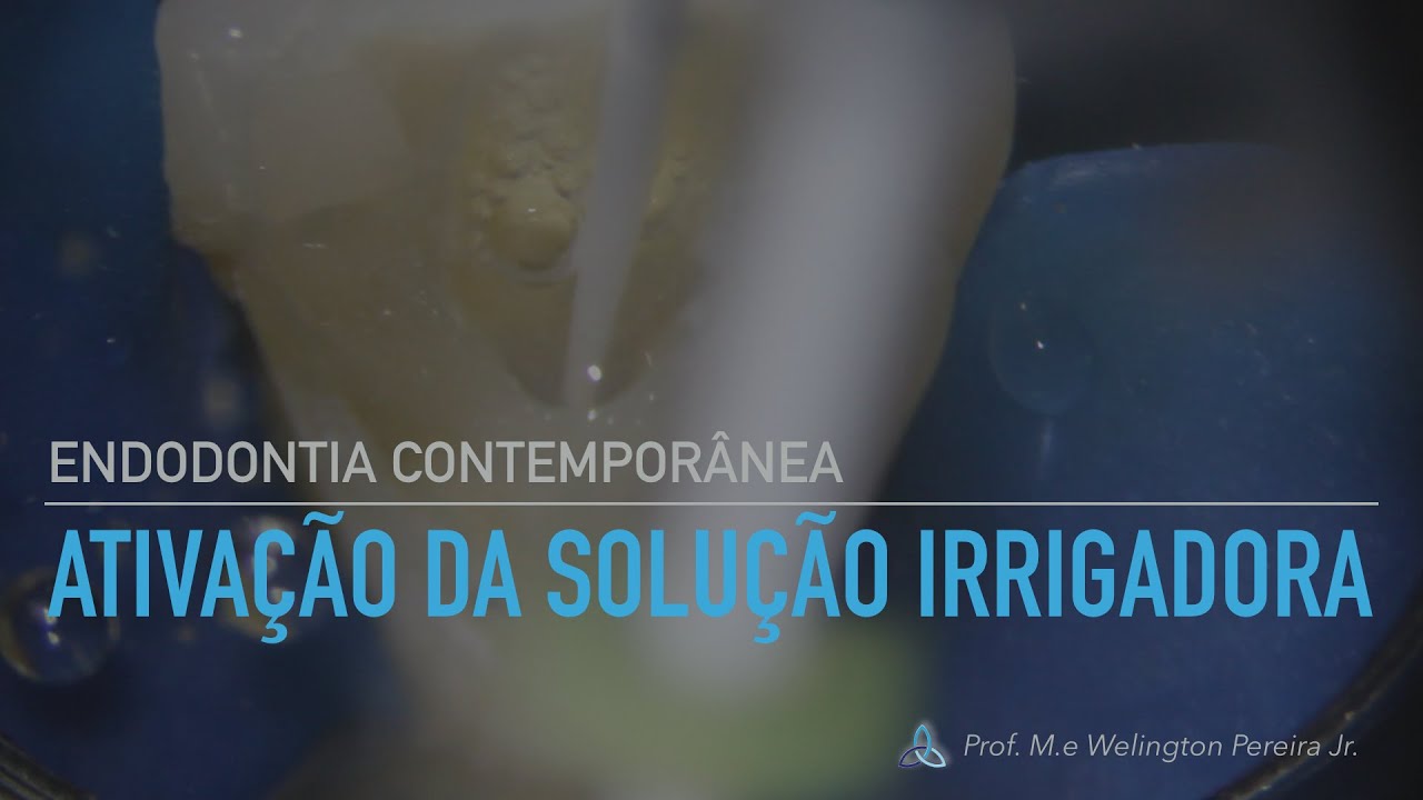 Ativação da Solução Irrigadora - PUI x EasyClean