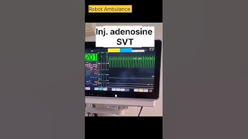 inj adenosine || SVT || ACLS || #adenosine #svt #acls #shorts #injection #viral #medicine #cardio