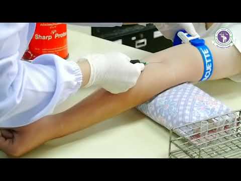 Video: Försenad Dubbelavläsning Av Fullständigt Blodkoaguleringstest (WBCT) Resultat Vid 20 Och 30 Minuter Förbättrar Diagnosen Och Behandlingen Av Huggormensvenomation
