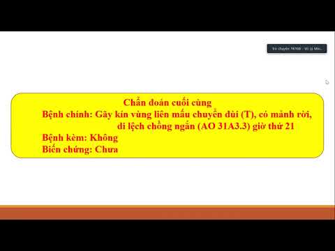 Video GIAO BAN BỆNH ÁN | GÃY LIÊN MẤU CHUYỂN XƯƠNG ĐÙI |... - youtube