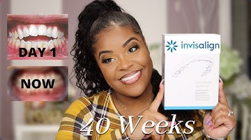 Invisalign Journey | Open Bite | 40 Week Update | Part 5