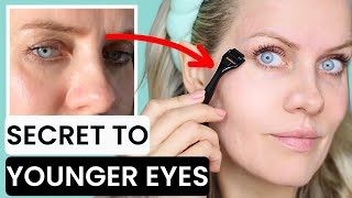 HOW TO GET RID OF CROW'S FEET AND SAGGY LIDS WITH DERMAROLLER