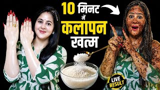 1 रात में चेहरा,गर्दन हाथ पैर का कालापन गायब 😳Dark Body Whitening Remedy 2026