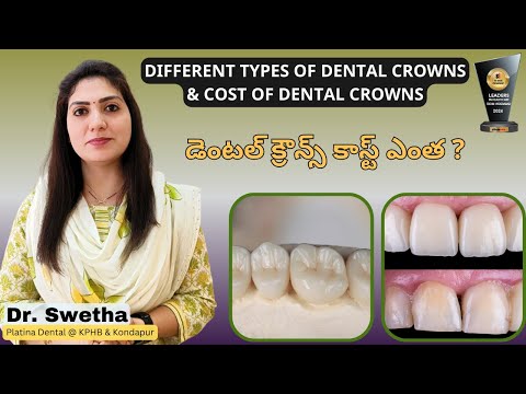 5 Types of Dental Crowns and Costs Involved | డెంటల్ క్రౌన్స్ కాస్ట్ ఎంత? | Platina Dental