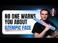 Ozempic Face Is Real: Here's What Actually Happens