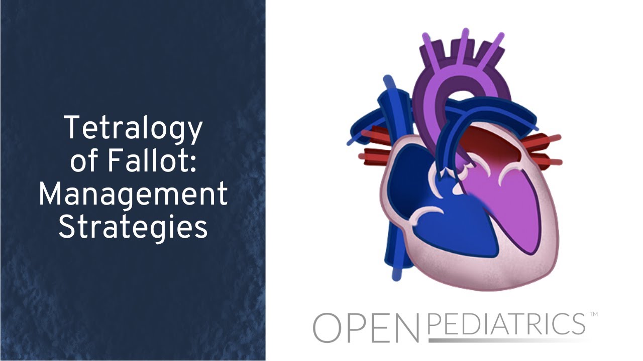 Tetralogy of Fallot: Management Strategies by P. Lang | OPENPediatrics