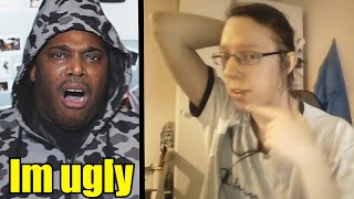 Being ugly : His Experience