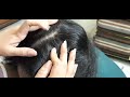 Full head scalp scratching video