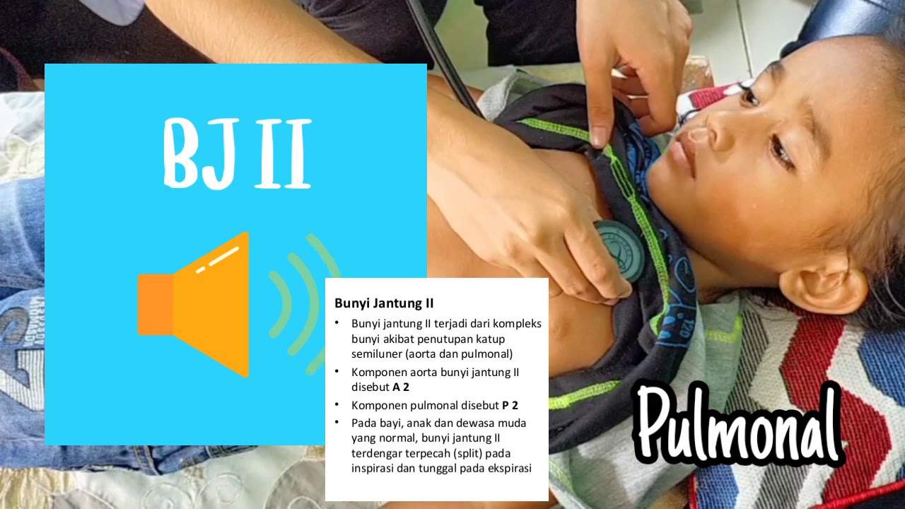 Pemeriksaan Fisik Jantung pada Anak