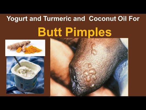 Home Remedies For Butt Pimples with Yogurt and Turmeric and  Coconut Oil