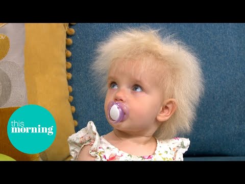 Meet The Toddler With Ultra-Rare Wild Hair Diagnosis | This Morning