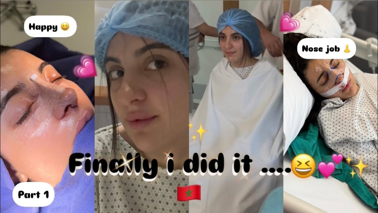 Finally i did it …. 👃✨ part 1 , شاركت معاكم تجربة عملية انفي
