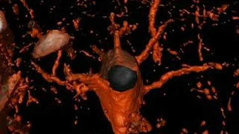 Pyramidal Neuron Cross Section