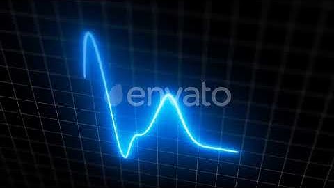 Blue heartbeat monitor EKG line monitor with moving camera processing heartthrob display | Motio...