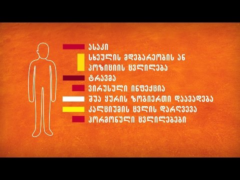 ყურში ქვიშის გავლა ანუ კეთილთვისებიანი თავბრუსხვევა