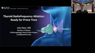 Thyroid Radiofrequency Ablation: Ready for Prime Time