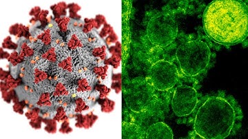 10 Deadly Viruses And Bacteria Created In Labs