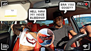 EXTREME BLOODY NOSE PRANK ON THE GANG TO SEE HIS REACTION !