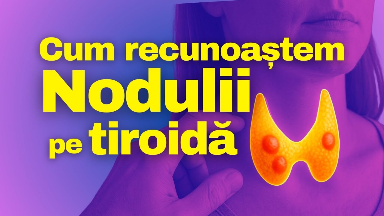 Nodulii pe TIROIDĂ: cum îi recunoaștem și când e CANCER
