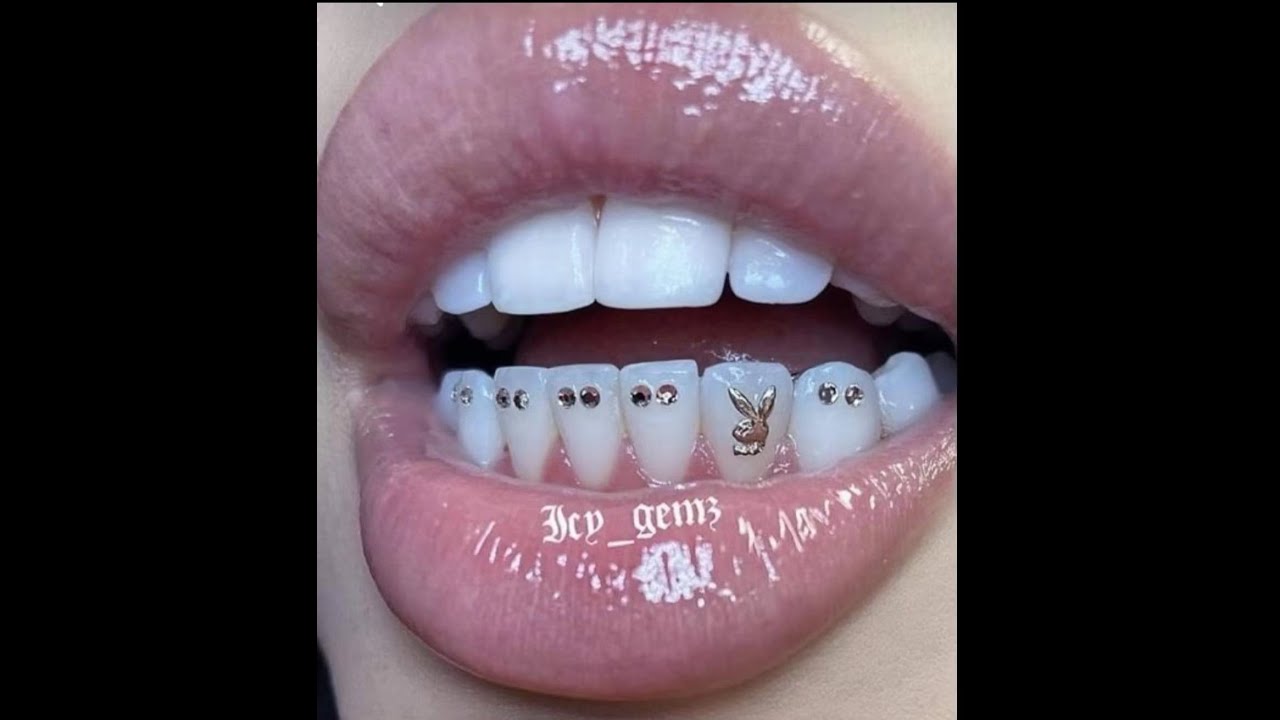 14k 18k 22kreal gold tooth gems