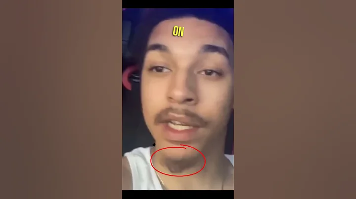 MoistCritical's Dissing Pranker Attempt of a Beard #shorts