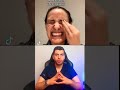 اكزيما اكزيما التهاب أكزيماجلدية حكة الجلد د مصعب حسوا ثقف نفسك طبيا