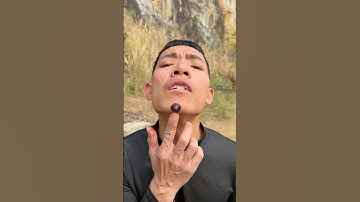 How I Treated Bug Bites with Yogurt in the Wild | Survival Tips