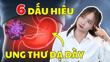 6 dấu hiệu cảnh báo sớm UNG THƯ DẠ DÀY từ cơn ĐAU BỤNG | Bác Sĩ Hoa