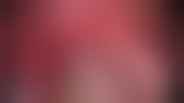 Asvide: Uniportal video-assisted thoracoscopic surgery left superior segmentectomy with systematic..