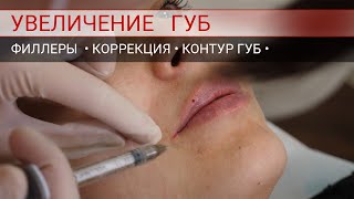 Коррекция губ. Коррекция контура губ и поднятие уголков губ.