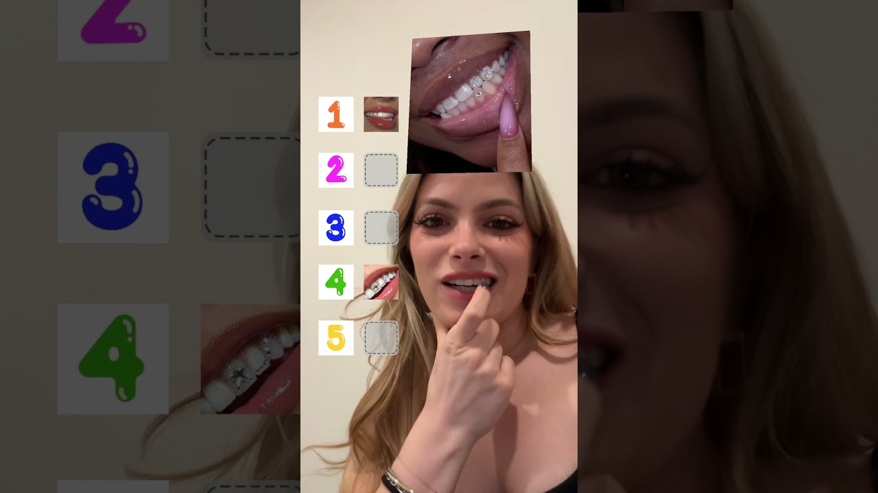 ranking top tooth gems🤩