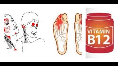 Never Ignore These Warning Signs Of Vitamin B12 Deficiency