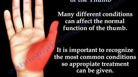 Common Conditions Of The Thumb - Everything You Need To Know - Dr. Nabil Ebraheim