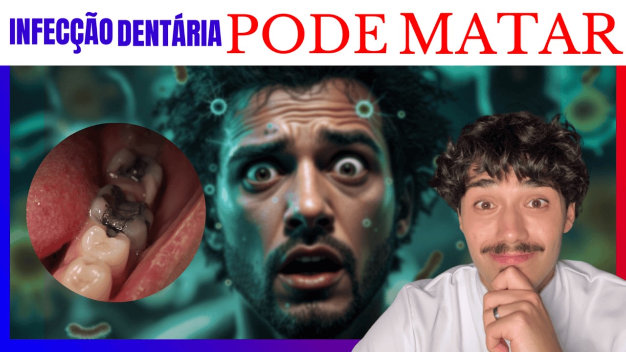 Dor de Dente Pode Matar? Descubra os Riscos e Como se Proteger! - YouTube
