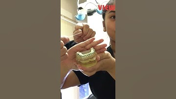 Flossing with Braces the RIGHT Way | View Mobile Dental