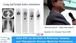 IAEA Workshop: 'Thyroid Cancer - Read with expert'